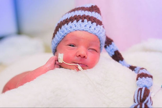 Ensaio de fotos com bebês na UTI neonatal faz sucesso na internet
