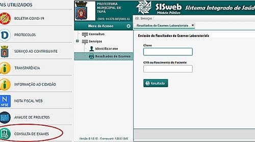 Resultados de exames da Unidade Covid podem ser emitidos no site da Prefeitura de Tupã