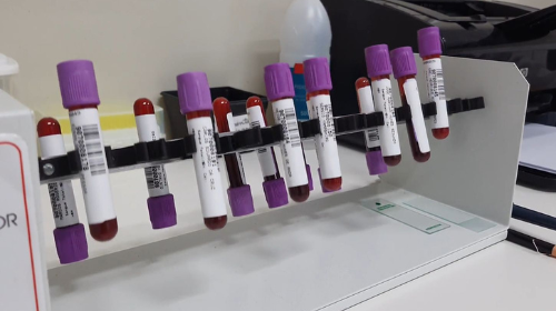 Laboratório São Paulo entrega resultado do exame de Dengue em menos de 24 horas
