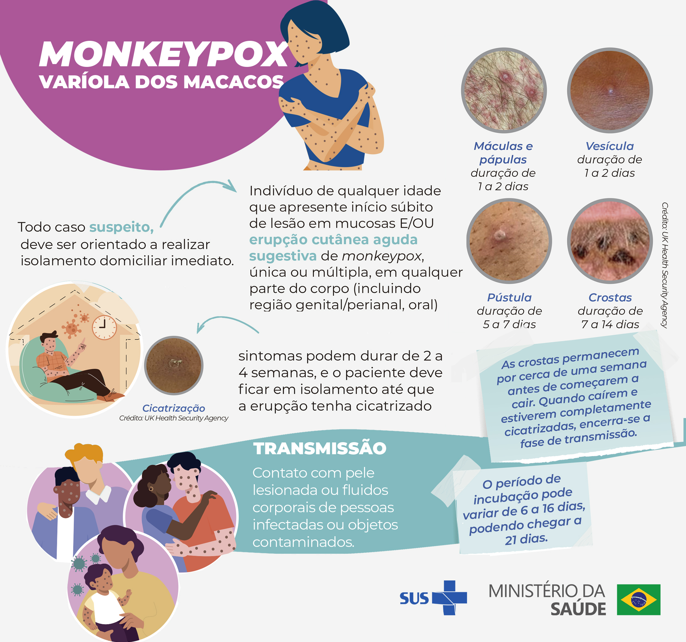 Pacientes suspeitos de monkeypox devem procurar UBS ou USF