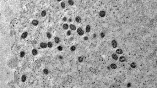 Ministério investe R$ 3 milhões em pesquisas sobre varíola dos macacos