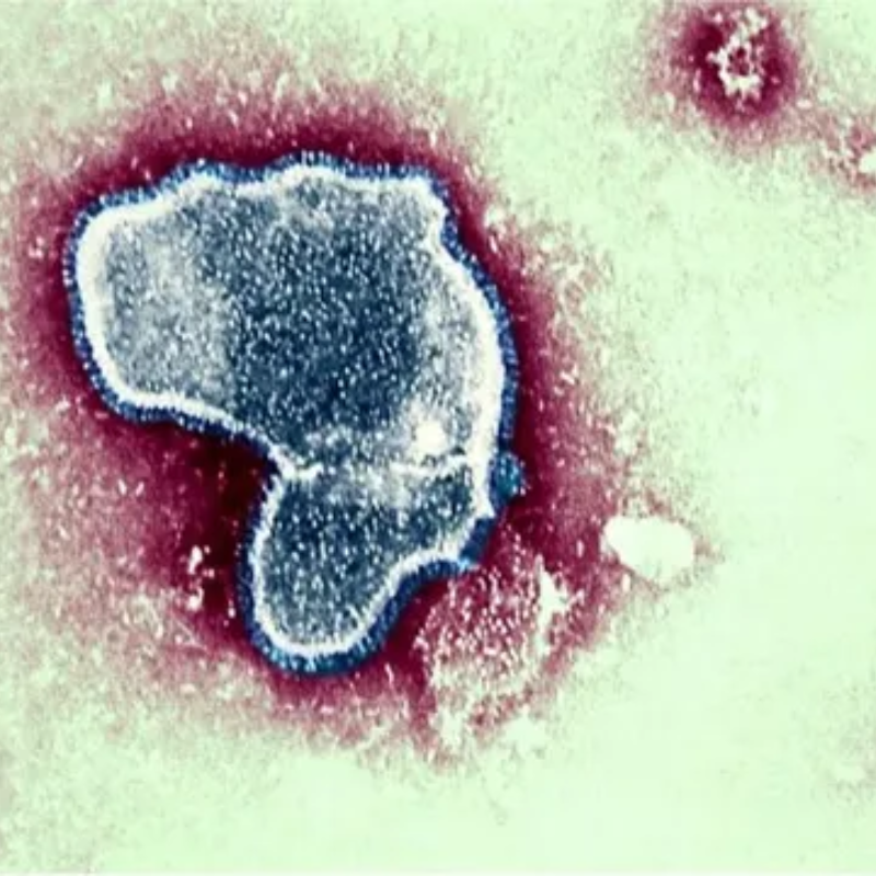 Marília confirma segunda morte por Vírus Sincicial Respiratório em 2023