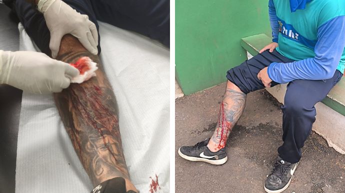 Vidro descartado de forma irregular fere coletor de reciclagem e gera apelo à população